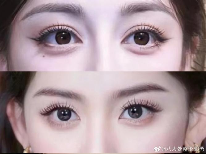 双眼皮美女明星_欧式双眼皮的女明星_娱乐圈欧式双眼皮的女星