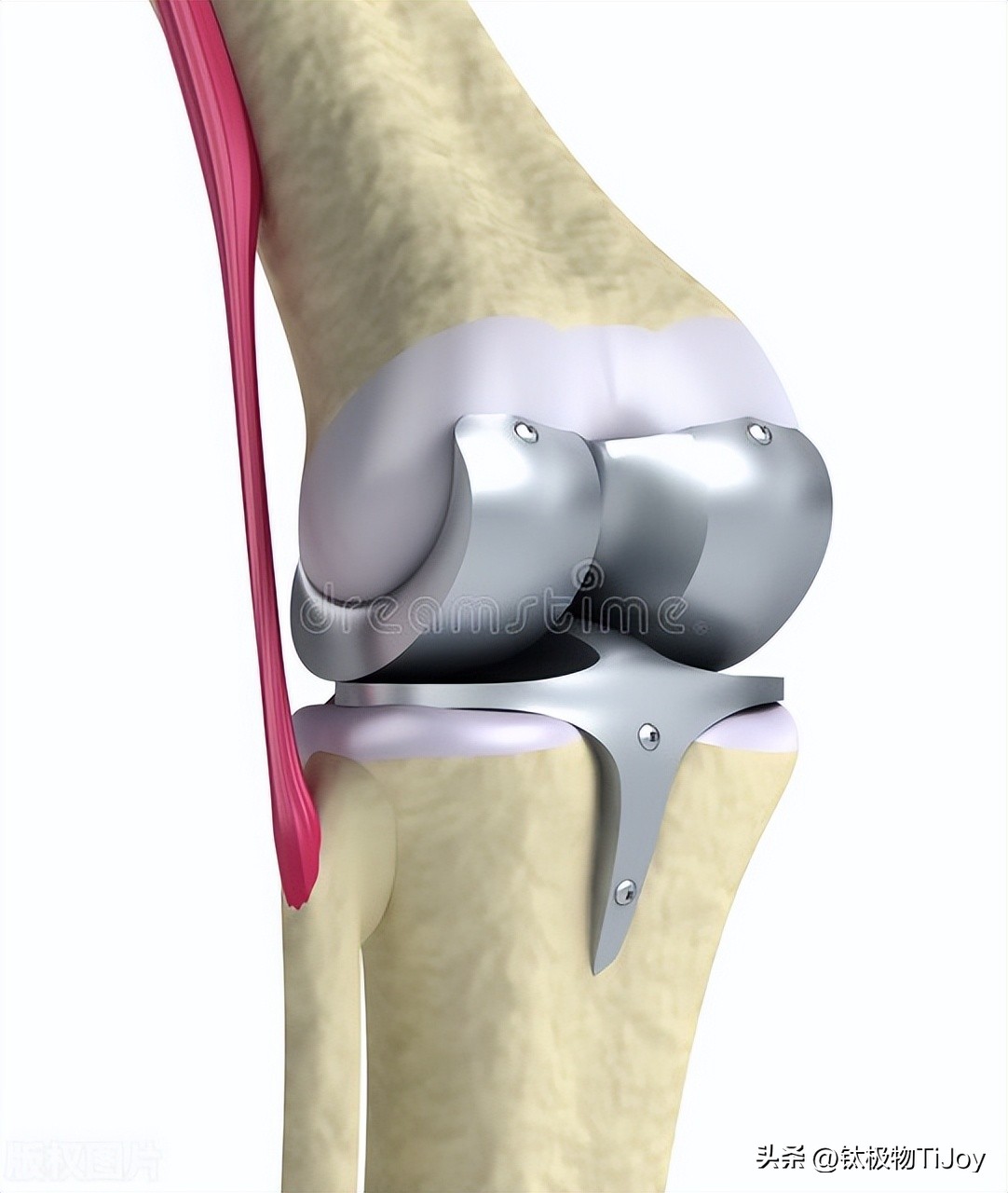 纯钛水杯选购指南_明星同款水杯热点,_钛杯品牌排行榜